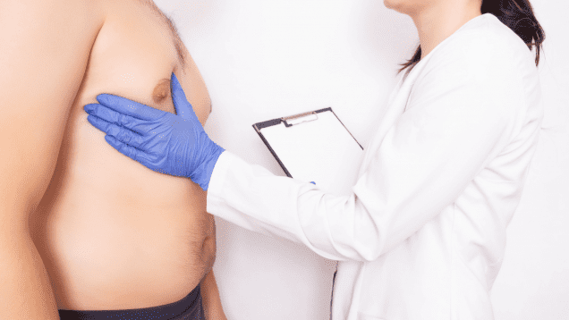 ginecomastia pectorales mamas masculinas pechos masculinos operacionales